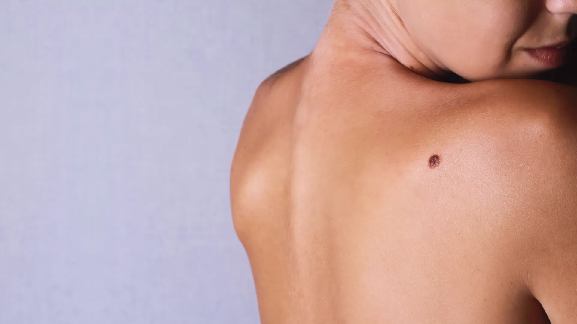mole removal
